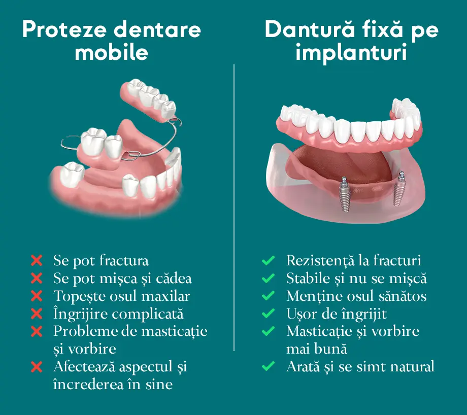 Comparație între proteze dentare mobile și dantură fixă pe implanturi